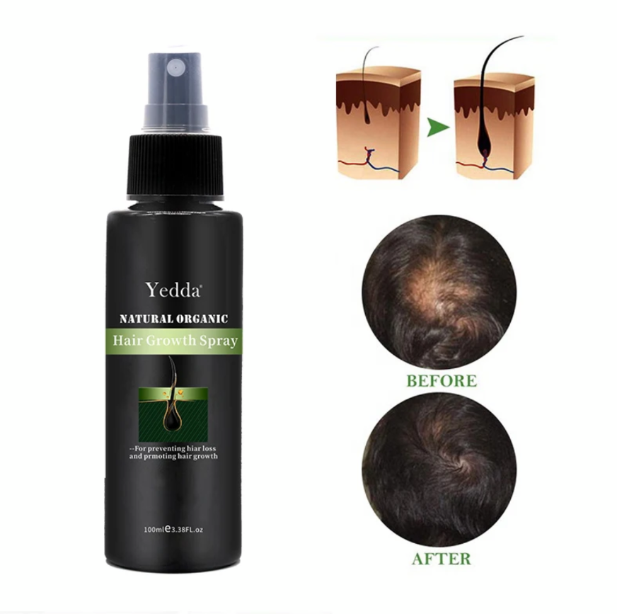 Yedda Hair Growth Spray&Shampoo, and Anti Hair Lose&Growth Essence,3 Bottles.